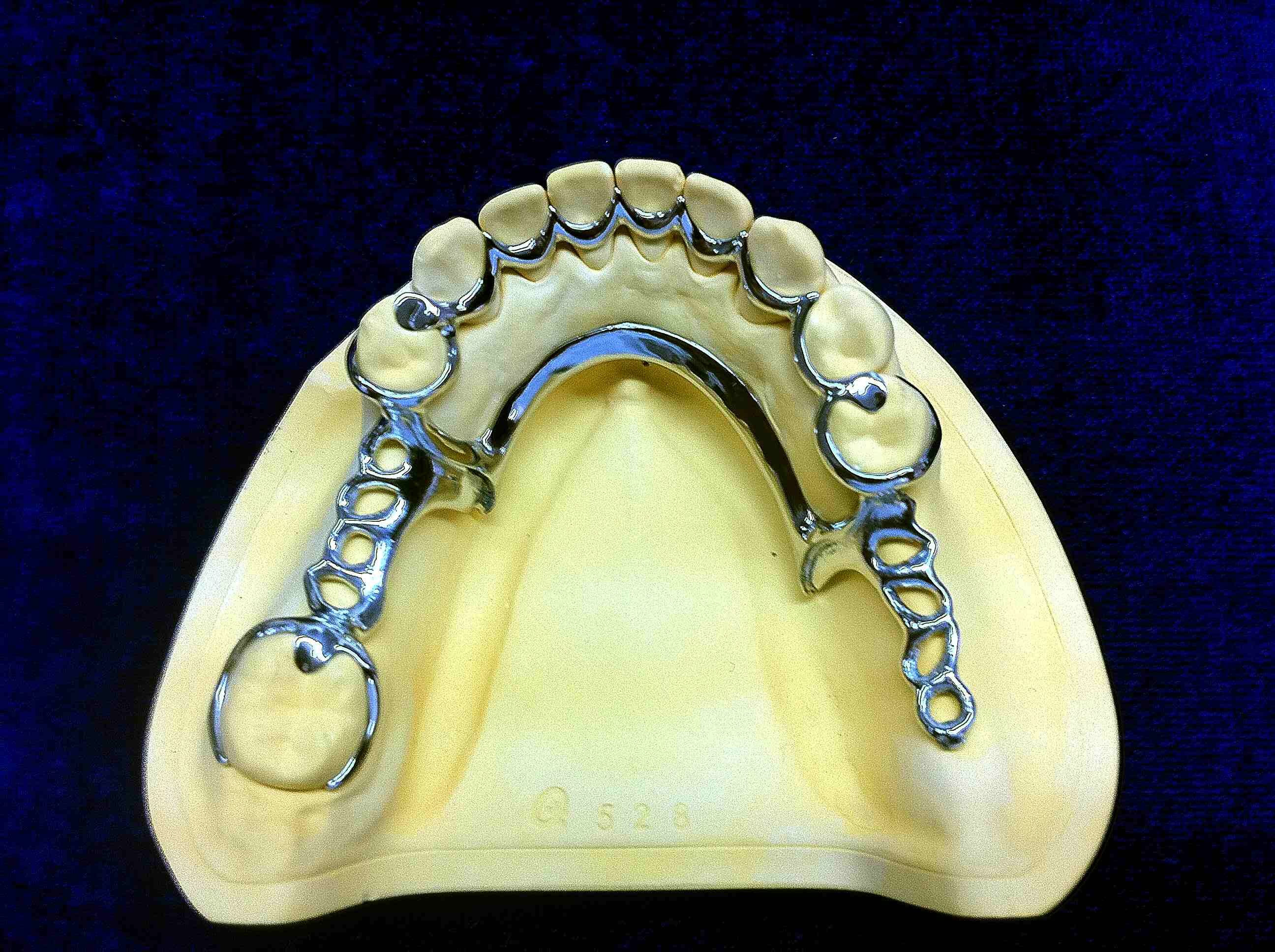 钴铬合金牙科材料 - remanium® star - DENTAURUM - 用于牙冠 / 用于牙桥